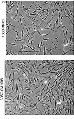 Gambar 3. Efek medium terkondisi stem cell stromal pada proliferasi fibroblas. Kiri: kontrol; kanan: ko-kultur fibroblas dengan medium terkondisi stem cell stromal2 