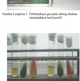 Gambar Lampiran 2. Tes Reaksi Biokimia   