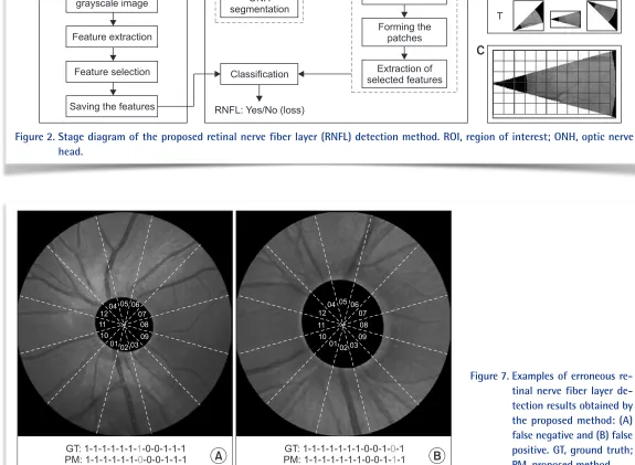 Figure 2.  Stage diagram of the proposed retinal nerve fiber layer (RNFL) detection method