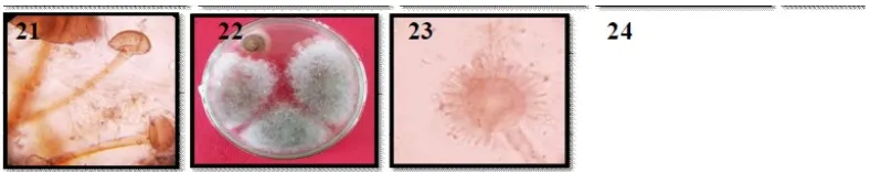 Gambar 1. Penampilan koloni cendawan pada media PDA yang berhasil diisolasidari sampel tanah perkebunan jambu mete setelah diinkubasi selama 2-3 hari