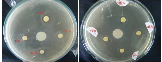 Gambar 4. Hasil uji sensitifitas beberapa konsentrasi minyak atsiri kemangi terhadap bakteri 