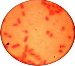 Gambar 2. Hasil uji mikroskopis bakteri Salmonella thypi dengan perbesaran 1000x 