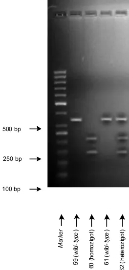 Gambar 2. Contoh hasil elektroforesis gel untuk amplifikasi dengan primer CYP1A1 (Ile462Val) 