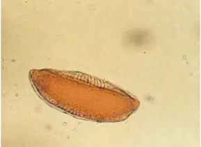 Gambar 2.1  TelurAnopheles8