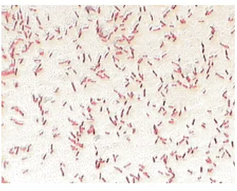 Gambar 2.1 Morfologi Proteus sp. (Sumber. http://lookfordiagnosis.com 2009) 