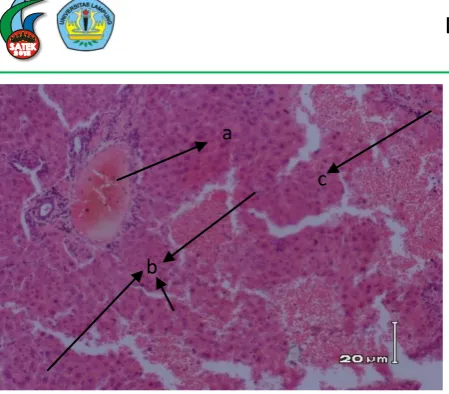 Gambar 10. Struktur histologi hati mencit (M. musculus L.) jantan yang diberi paparan 