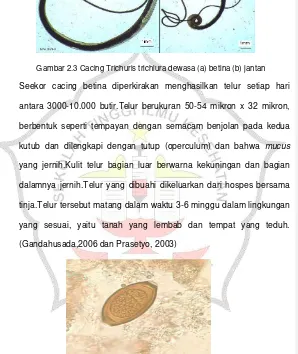 Gambar 2.4 Telur cacing Trichuris trichiura(http://www.google.co.id/search gambar telur cacing Trichuris trichiura