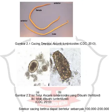Gambar 2.1 Cacing Dewasa Ascaris lumbricoides (CDC, 2013). 