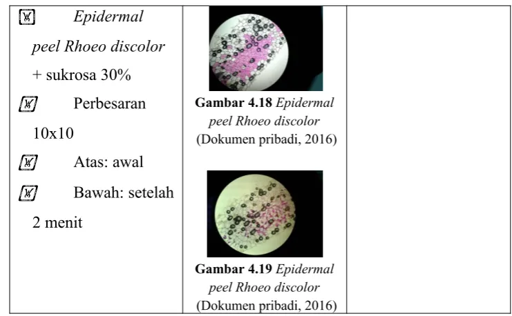Gambar 4.18 Epidermal