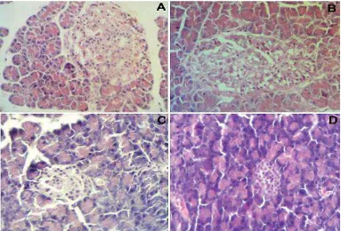 Fig 1 Histological pattern of liver from nondiabetic control mice showing normal appearing of hepatocytes, portal space, sinusoids, and Kuppfer cells (A); Histological pattern of liver in untreated diabetic showing severe fatty degeneration, sinusoidal enl