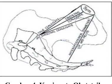 Gambar 4. Konjugata Obstetrika