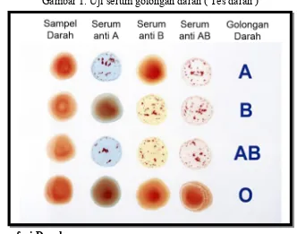 Gambar 1. Uji serum golongan darah ( Tes darah )
