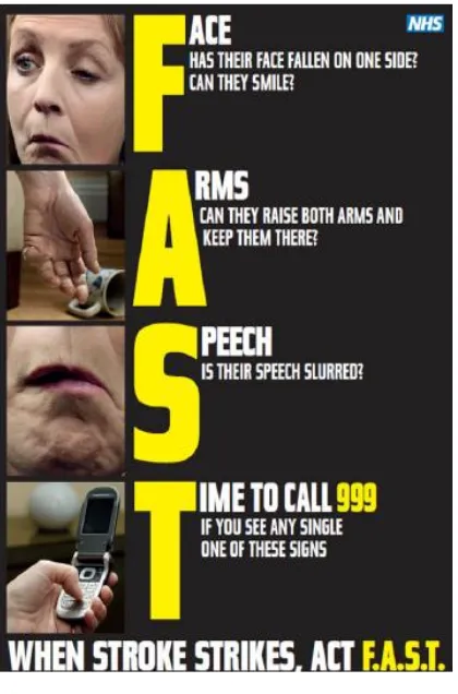 Gambar 1. Leaflet sebagai kampanye media massa  mengenai tanda awal gejala stroke.21 