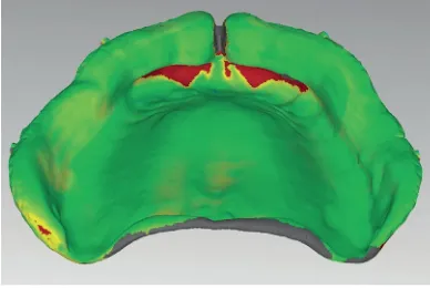 Gambar  2.  Tampilan  digital  basispencatat dengan CAD/CAM.