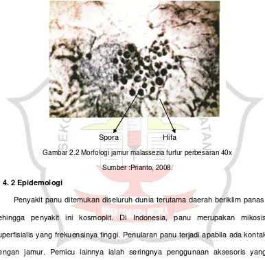 Gambar 2.2 Morfologi jamur malassezia furfur perbesaran 40x 