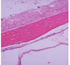 Gambar 14. Mikrostruktur 