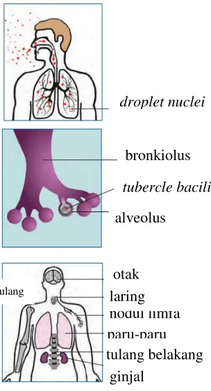 Gambar 19. Patogenesis Penyakit TB dan LTBI (CDC, 2016) 