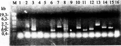 Figure 1.  High efficiency of P. amabilis orchid cDNA library. PCR analysis revealed about 87.5% plaques contained insert cDNA(s)