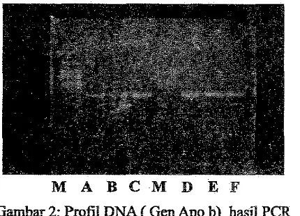 Gambar 2: Profil DNA ( Gen Apo b) basil PCR 