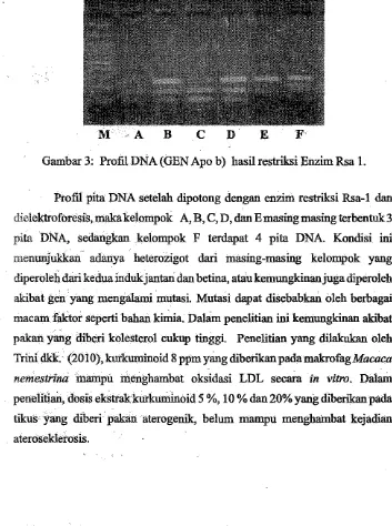 Gambar 3: Profil DNA (GEN Apo b) basil restriksi Enzim Rsa 1. 