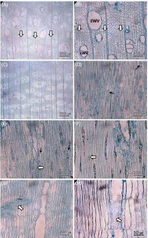 Fig. 2. Light micrographs of Paulownia tomentosa root wood: (A and B) earlywood vessels (EWV) and latewood vessels (LWV) with indistinct growth ring (arrows) in cross section; (C) aliform and confluent axial parenchyma in a cross section of latewood; (D) top part with sheath cells; (E) middle part with septate axial parenchyma (black arrows) and simple perforation plates (white arrow) in tangential section; (F) base part with uniseriate ray(white arrow); (G) procumbent rays in radial section; (H) alternate intervascular pits (white arrow).