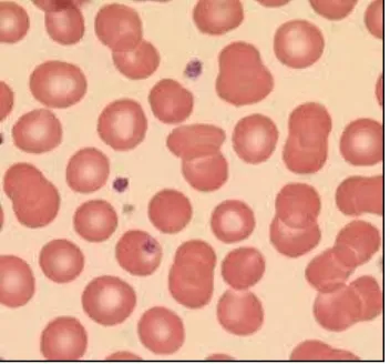 Gambar 2.2 Sel Darah Merah Normal  