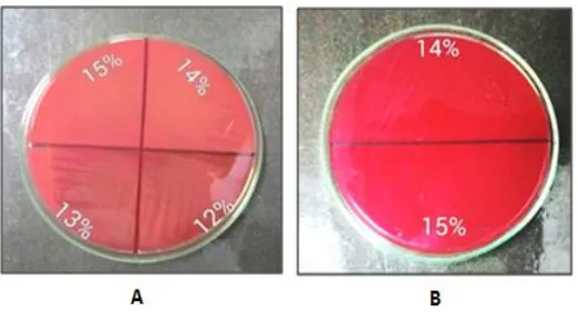Figure 1. Photographs depicted the growth of S.mutansused in MIC test. (A) Comparison between the concentration in the MIC test where bacterial growth  was visible (12% and 13%) and that was not (14% and 15%); (B) Growth of  inocula taken from solution S