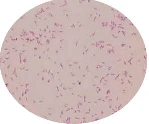 Gambar 2.1 Bakteri Shigella sp. (Diana, 2014) 
