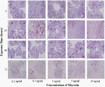 Fig. 2:  Immunocytochemical expression of p53 protein in T47D cells treated with mucoxin with different concentrations at different exposure times