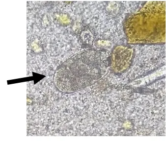 Gambar 5.1. Telur Hook worm perbesaran 400x menggunakan reagen formalin dan eter  