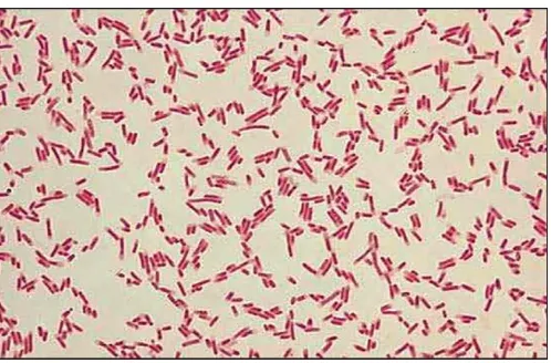 Gambar 2.3 Escherichia coli (Prix, 2018). 