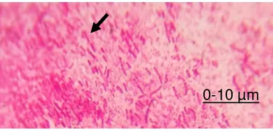 Gambar 5.1  Bakteri Salmonella sp pada pewarnaan gram 