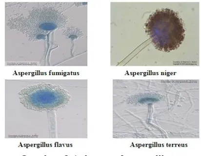 Gambar 2.1 Jamur Aspergillus sp 