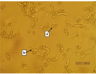 Gambar 4.Viabilitas (perkecambahan)  spora M. anisopliae pada beberapa isolat yang diuji 