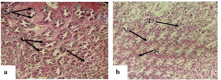 Figure 4. Comparative hepatopancreatic conditions of shrimps fed on Diet A, control (4% prebiotic and 6% probiotic, w/w (a a) and Diet D b), histologically