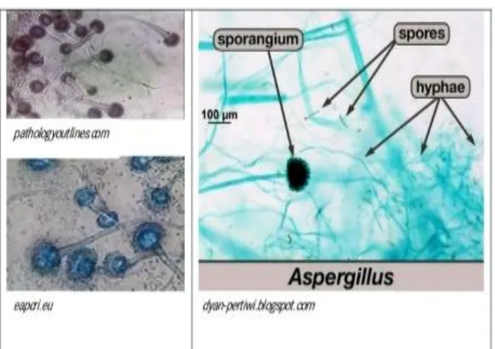 Gambar 2.3 : Aspergillus Sp pada pemeriksaan mikroskopis 