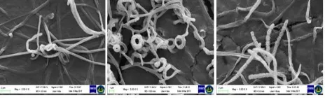 Figure 3. SEM of actinomycetes of two different 