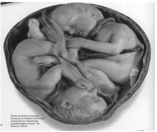 Gambar Perkembangan embrio pada 5,14,20 minggu 