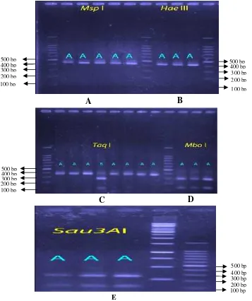 Gambar 6. Pola fragmen mtDNA COI pada elektroforesis gelKeterangan : A= enzim Msp I; B= enzim Hae III; C= enzimTaq I; D= enzim Mbo I; E=enzimSau3A I