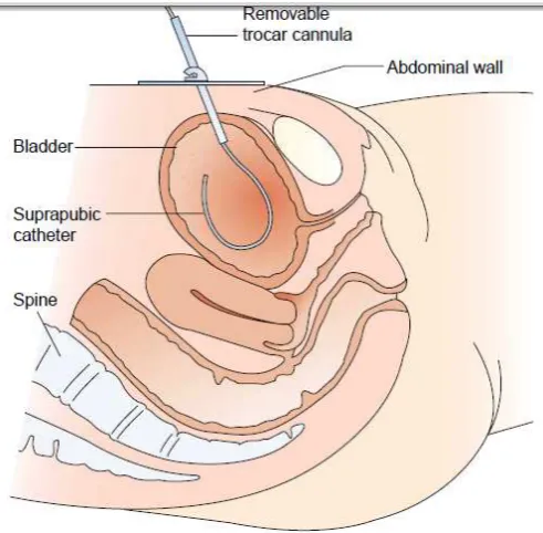 Gambar 1. Bladder 