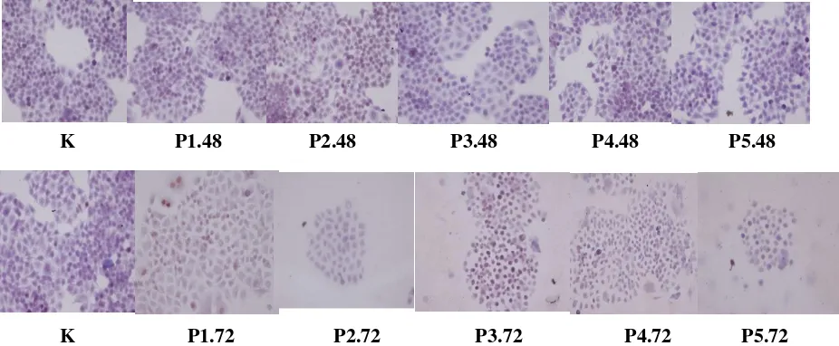 Fig. 1: Immunocytochemistry expression of p53 protein in breast cancer cells treated with mucoxin in different concentration and exposure time 
