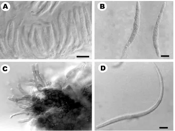 Gambar 2  Struktur Teleomorf and anamorf Mycosphaerella fori (PREM 57305) 