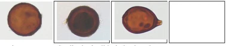Gambar 4.  Spora endomikoriza hasil isolasi yaitu Glomus 