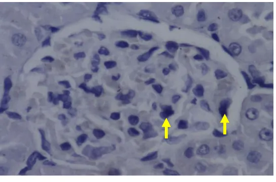 Gambar 3. Gambaran mikroskopis reseptor AGE di glomerolus ginjal tikus kelompok kontrol (STZ) dengan pembesaran 400X (tanda panah menandai sel yang mengekspresikan RAGE) 