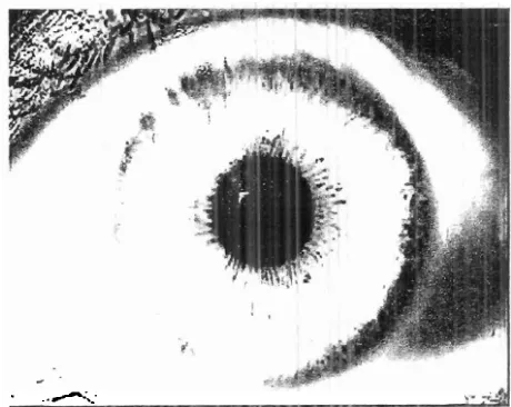 Gambar 1. Iris Mata Manusia (Navratil, F. 2010) 