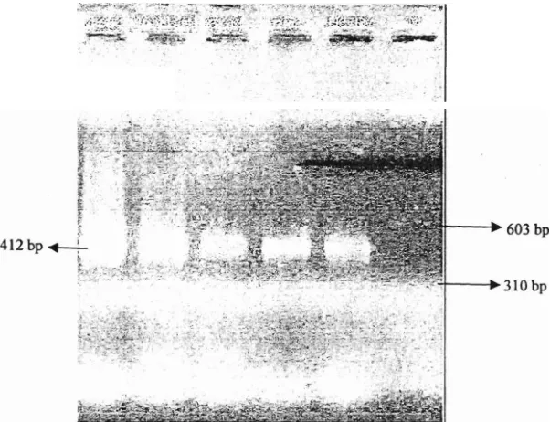 Gambar 5.1: Hasil elektroforesis produk PCR kontrol yang akan digunakan untuk optimasi reaksi reverse hibridiasi pada gel agarose 1,2%