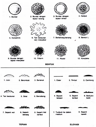 Gambar 2. Morfologi Koloni Bakteri (Hadioetomo, 1993) 