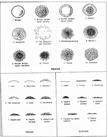 Gambar 2. Morfologi Koloni Bakteri (Hadioetomo, 1993) 