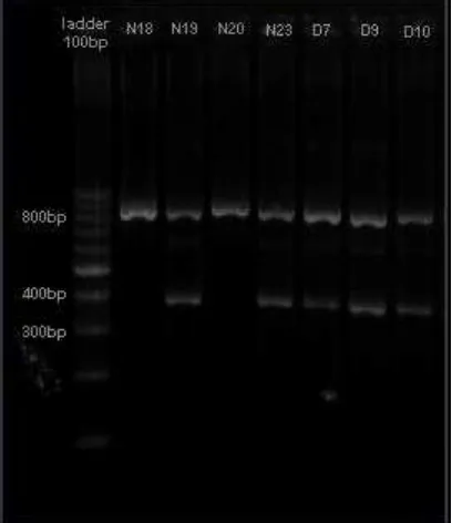 Gambar 5 Hasil sekuensing sampel yang mengalami polimorpisme padaGambar 5 Hasil sekuensing sampel yang mengalami polimorpisme padaGambar 5 Hasil sekuensing sampel yang mengalami polimorpisme pada rs12255372 rs12255372 rs12255372