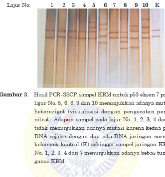 Gambar . Hasil PCR-SSCP sampel KRM untuk p53 ekson 7 pada 